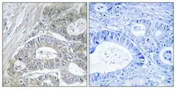 Anti-GPRIN2 antibody used in IHC (Paraffin sections) (IHC-P). GTX87076