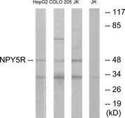 Anti-NPY5R antibody used in Western Blot (WB). GTX87079