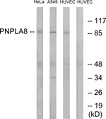 Anti-PNPLA8 antibody used in Western Blot (WB). GTX87080
