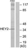 Anti-HEY2 antibody used in Western Blot (WB). GTX87082