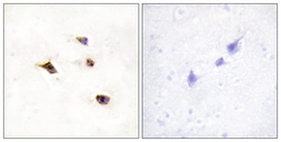 Anti-IP6K3 antibody used in IHC (Paraffin sections) (IHC-P). GTX87084