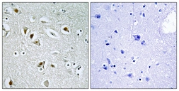 Anti-CDK2AP2 antibody used in IHC (Paraffin sections) (IHC-P). GTX87086