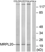 Anti-MRPL20 antibody used in Western Blot (WB). GTX87089
