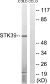 Anti-STK39 antibody used in Western Blot (WB). GTX87091