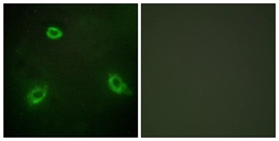 Anti-Anoctamin 7 antibody used in Immunocytochemistry/ Immunofluorescence (ICC/IF). GTX87092