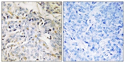 Anti-RBM34 antibody used in IHC (Paraffin sections) (IHC-P). GTX87094