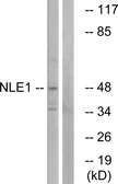Anti-NLE1 antibody used in Western Blot (WB). GTX87095