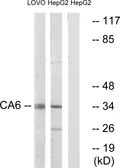 Anti-CA6 antibody used in Western Blot (WB). GTX87102