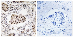 Anti-PPP1R11 antibody used in IHC (Paraffin sections) (IHC-P). GTX87103