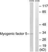 Anti-MYF5 antibody used in Western Blot (WB). GTX87110