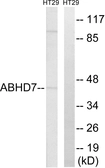 Anti-ABHD7 antibody used in Western Blot (WB). GTX87116