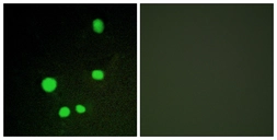 Anti-MED14 antibody used in Immunocytochemistry/ Immunofluorescence (ICC/IF). GTX87124