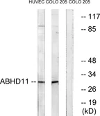 Anti-ABHD11 antibody used in Western Blot (WB). GTX87129