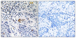 Anti-ZBTB40 antibody used in IHC (Paraffin sections) (IHC-P). GTX87131