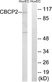 Anti-AGBL2 antibody used in Western Blot (WB). GTX87142