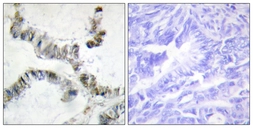 Anti-HMGXB3 antibody used in IHC (Paraffin sections) (IHC-P). GTX87144