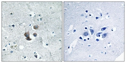 Anti-IGFBP7 antibody used in IHC (Paraffin sections) (IHC-P). GTX87146