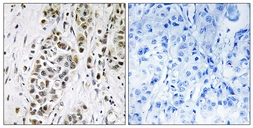 Anti-XRN2 antibody used in IHC (Paraffin sections) (IHC-P). GTX87148
