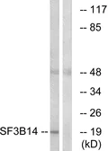 Anti-SF3B14 antibody used in Western Blot (WB). GTX87151