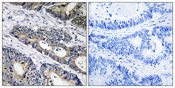 Anti-GLB1L3 antibody used in IHC (Paraffin sections) (IHC-P). GTX87152
