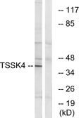 Anti-TSSK4 antibody used in Western Blot (WB). GTX87154