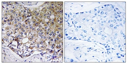 Anti-ATG4A antibody used in IHC (Paraffin sections) (IHC-P). GTX87155