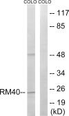 Anti-MRPL40 antibody used in Western Blot (WB). GTX87165