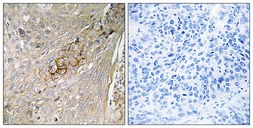 Anti-SLC6A6 antibody used in IHC (Paraffin sections) (IHC-P). GTX87166