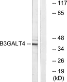Anti-B3GALT4 antibody used in Western Blot (WB). GTX87167