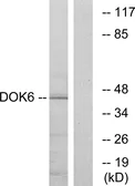 Anti-DOK6 antibody used in Western Blot (WB). GTX87172