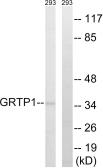 Anti-GRTP1 antibody used in Western Blot (WB). GTX87173