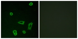 Anti-GPR50 antibody used in Immunocytochemistry/ Immunofluorescence (ICC/IF). GTX87181