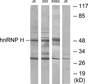 Anti-hnRNP H antibody used in Western Blot (WB). GTX87182