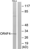 Anti-OR4F4 antibody used in Western Blot (WB). GTX87184