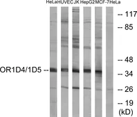 Anti-OR1D4 + OR1D5 antibody used in Western Blot (WB). GTX87186