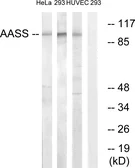 Anti-AASS antibody used in Western Blot (WB). GTX87191