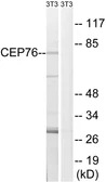 Anti-CEP76 antibody used in Western Blot (WB). GTX87193
