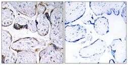Anti-ELOVL3 antibody used in IHC (Paraffin sections) (IHC-P). GTX87195