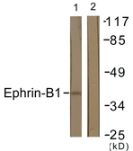 Anti-Ephrin B1 antibody used in Western Blot (WB). GTX87196