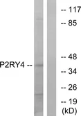 Anti-P2Y4 antibody used in Western Blot (WB). GTX87199