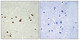 Anti-ANKRD26 antibody used in IHC (Paraffin sections) (IHC-P). GTX87200