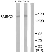 Anti-SMARCC2 / BAF170 antibody used in Western Blot (WB). GTX87201
