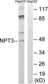 Anti-SLC17A2 antibody used in Western Blot (WB). GTX87203