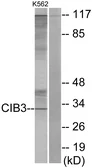 Anti-CIB3 antibody used in Western Blot (WB). GTX87207
