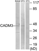 Anti-CADM3 antibody used in Western Blot (WB). GTX87213