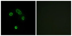 Anti-TAS2R13 antibody used in Immunocytochemistry/ Immunofluorescence (ICC/IF). GTX87215