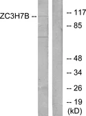 Anti-ZC3H7B antibody used in Western Blot (WB). GTX87217