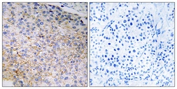 Anti-NOX3 antibody used in IHC (Paraffin sections) (IHC-P). GTX87223