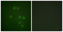 Anti-HMG14 antibody used in Immunocytochemistry/ Immunofluorescence (ICC/IF). GTX87226