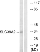 Anti-SLC39A2 antibody used in Western Blot (WB). GTX87228